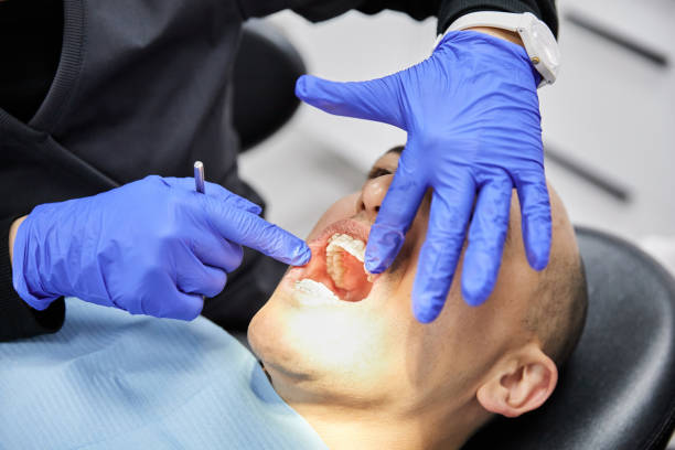 Best Emergency Wisdom Teeth Removal in Gamerco, NM