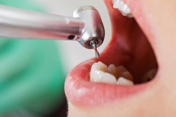 Best Emergency Treatment for Toothache in Gamerco, NM